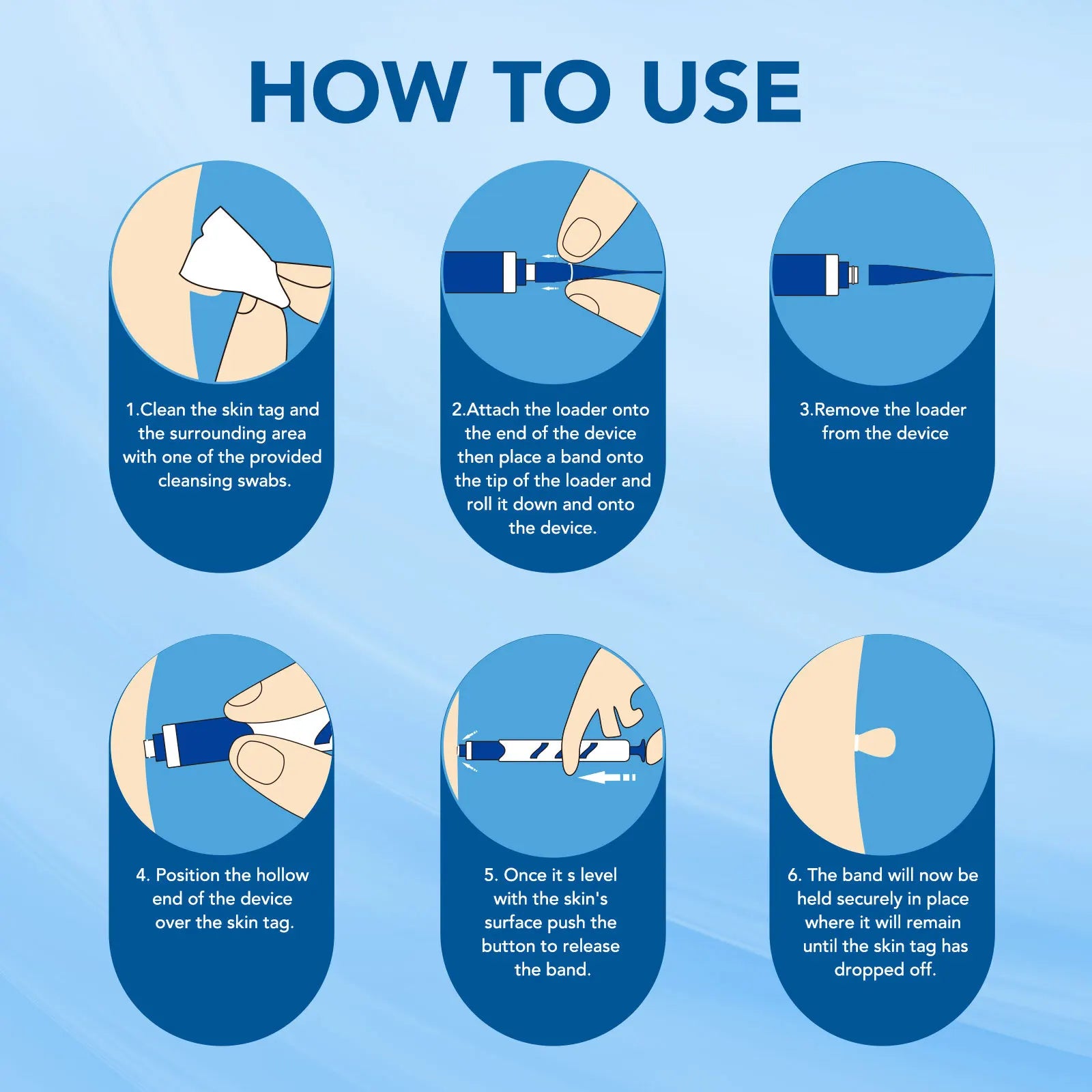 3 In1 Painless Auto Skin Tag Mole Wart Removal Kit Cleaning Tool Care Body Wart Dot Treatment for 1-4Mm Beauty Health Hot Sale